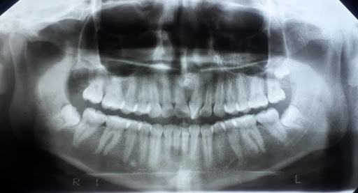 Dental San Ángel