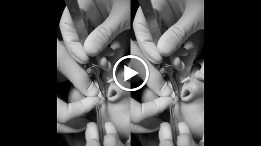FACE CLINIC - Clínica Dental y Maxilofacial, Cirugía y Medicina Estética, injerto Capilar