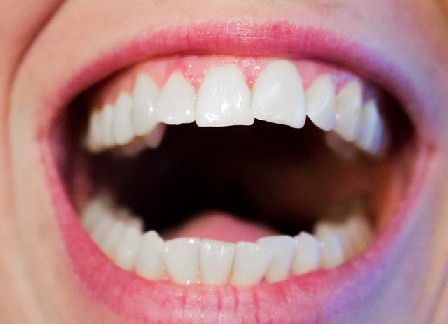 מרפאת שיניים: 5 טיפים לשדרוג החוויה לנעימה וחמה