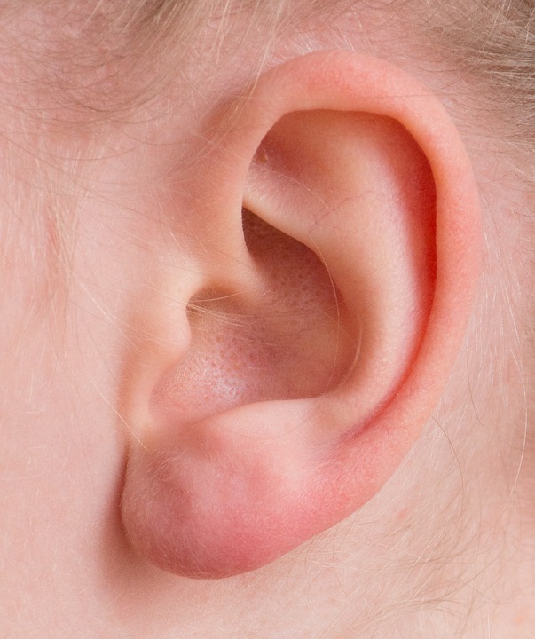 מתי מתאים לעשות ניתוח הצמדת אוזניים?