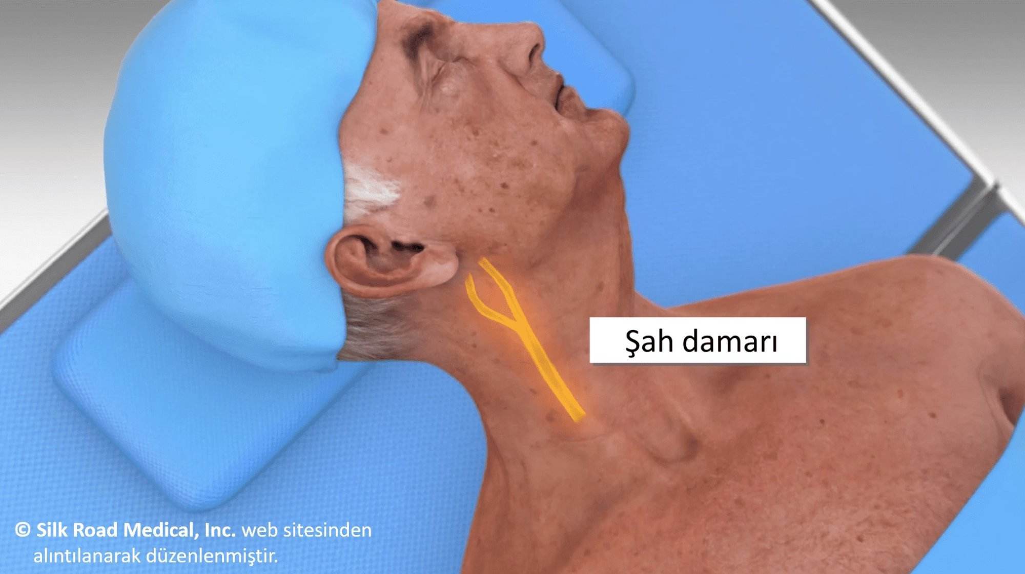 şah damarı hangi damar?