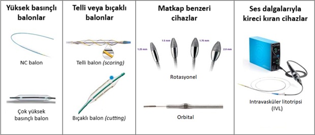 Kireçli damar nasıl açılır