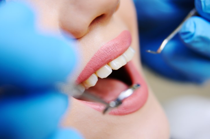 לטפל בשיניים בצורה הכי יסודית