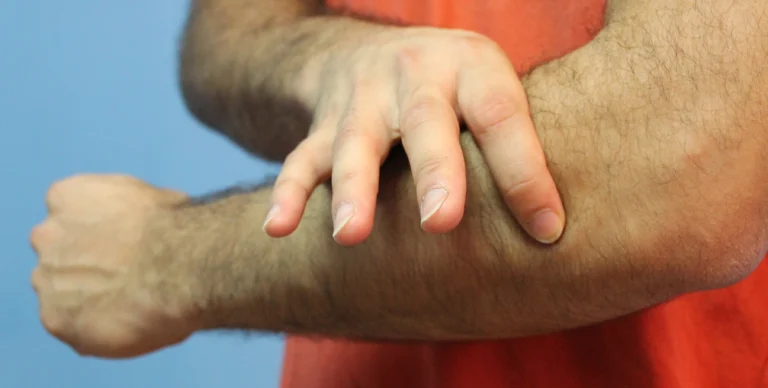 Automasajes y técnicas de liberación para aliviar la epicondilitis en casa