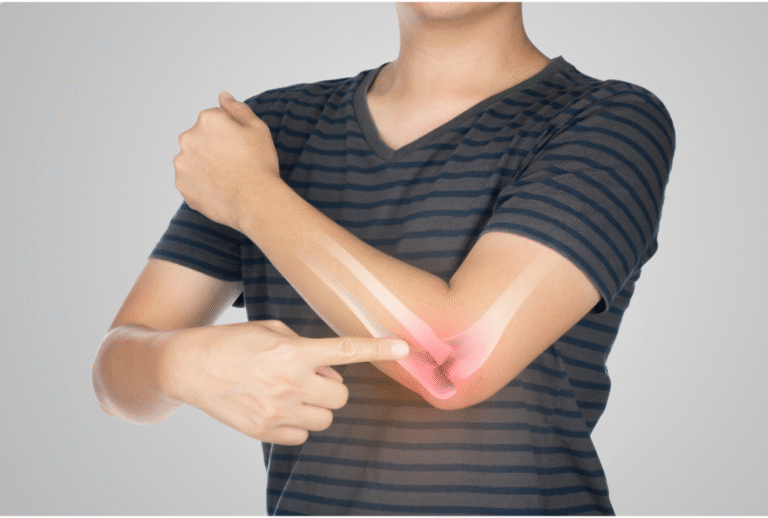 Epicondilitis y problemas digestivos: descubre cómo afectan a tu recuperación real