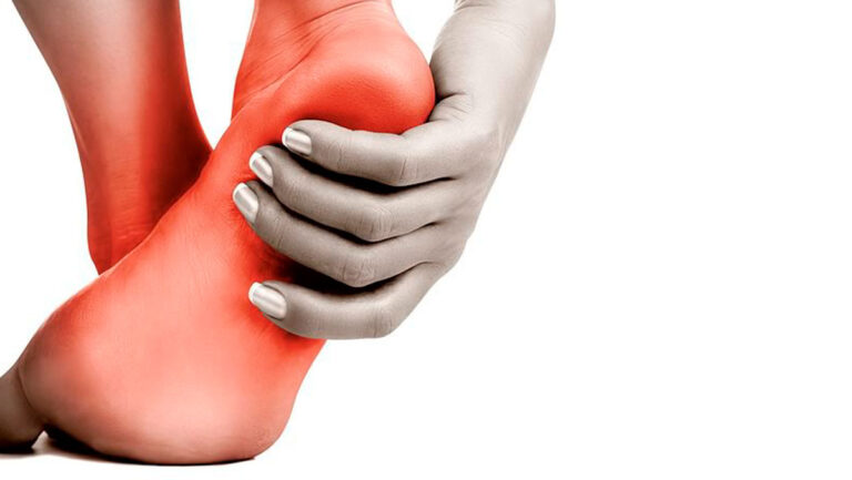 Tratamiento integral para la fascitis plantar sin necesidad de acudir a consulta
