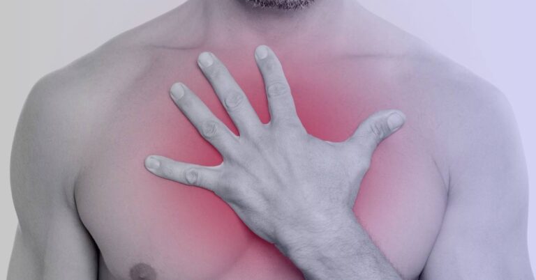 ¿Te duele el cartílago esternal al presionarlo? Podrías tener Síndrome de Tietze