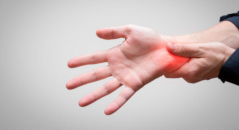 El origen real del túnel carpiano: por qué los tratamientos convencionales fallan
