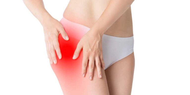 Errores comunes que mantienen tu trocanteritis sin curarse del todo