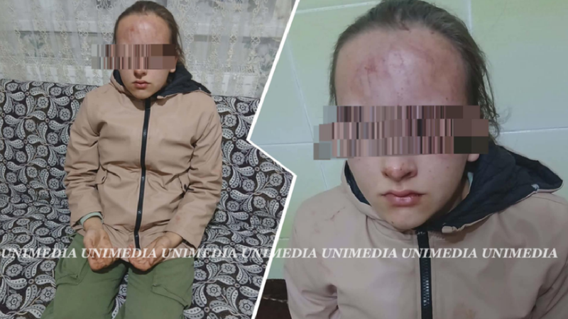  Noi detalii despre copila din Ialoveni, bătută de 2 fete: Tinerele riscă pușcărie
