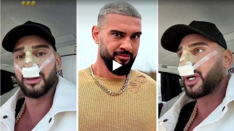  (VIDEO) Dorian Popa, la un pas să îi „cadă nasul ca lui Michael Jackson”. Ce i-a descoperit medicul la operație: „Habar nu aveam”