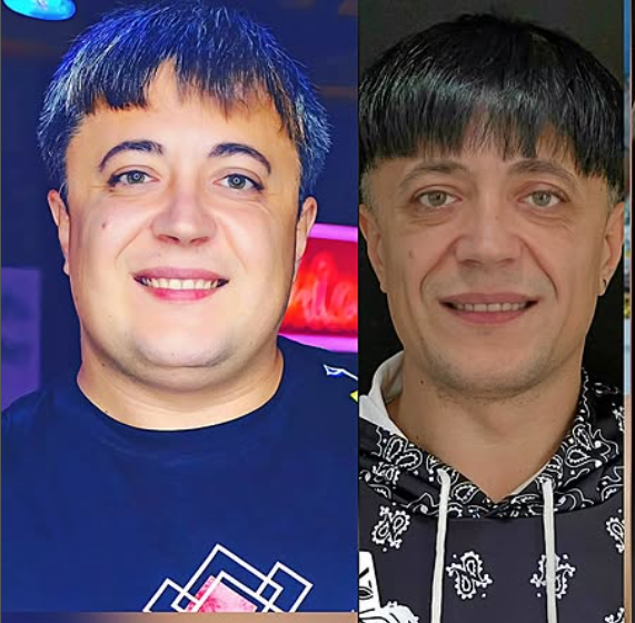  (FOTO) Bisturiu, hematoame și săptămâni de recuperare: Rețeta „tinereții veșnice” a lui Vlad Codreanu. „Am suferit mult ca să arăt așa”