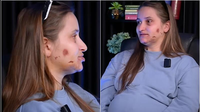 (VIDEO) „Mi-a pus piciorul pe cap și cu degetele voia să-mi rupă gura”. O tânără însărcinată în luna a 9-a, bătută cu bestialitate de cumnatul său în ograda socrilor, la Anenii Noi