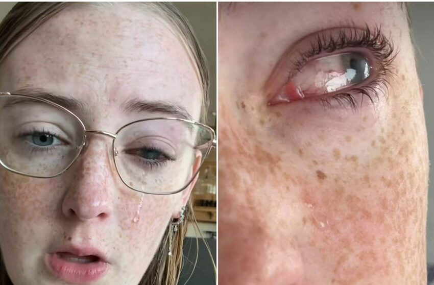  (VIDEO) O tânără de 20 de ani din SUA a orbit parțial din cauza lentilelor de contact! Greșeala care i-a distrus viața: „M-am infectat cu…”
