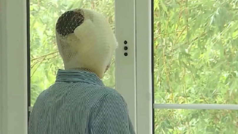  Și-a urmărit fosta parteneră și a atacat-o cu acid: Câți ani de închisoare a primit agresorul