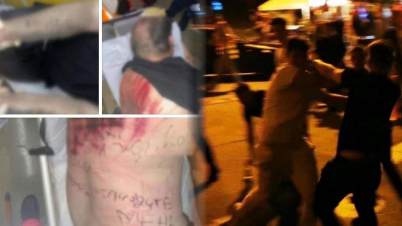  (FOTO 18+) Bătut cu cruzime și ars pe corp: Imagini greu de privit cu studentul de 19 ani, agresat de un grup de tineri, lângă un cămin UTM