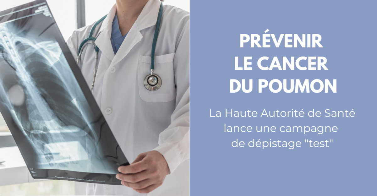 Cancer du poumon : un programme pilote pour mieux le dépister image