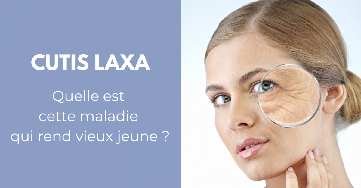Cutis Laxa : quelle est cette maladie de peau qui provoque un vieillissement cutané prématuré ?