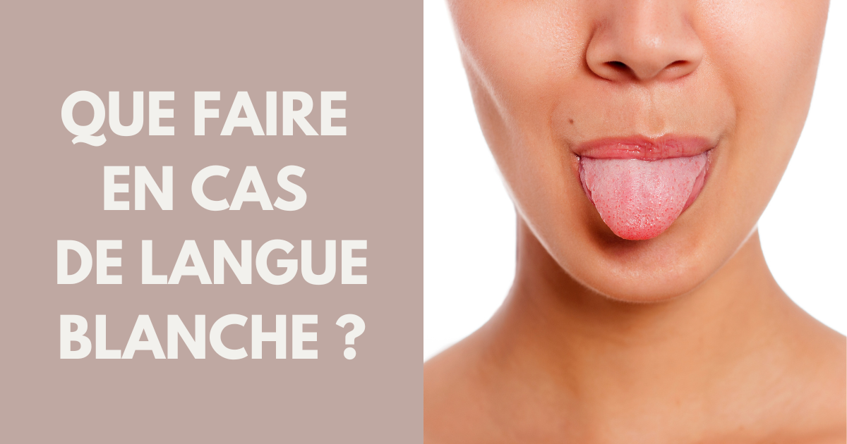 Langue blanche : 4 causes possibles