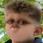 Kyle Möbius
