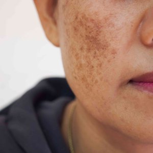 30_Pigmentation2.jpg