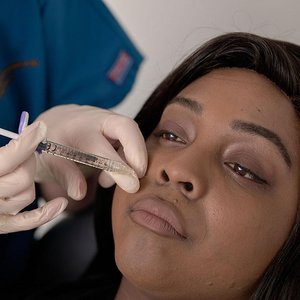 DermaFillerMain.jpeg