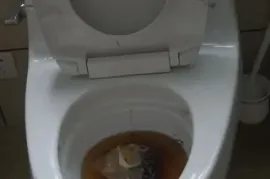 KANALIZACIIS GAWMENDA 24 SAATI 557 77 78 06